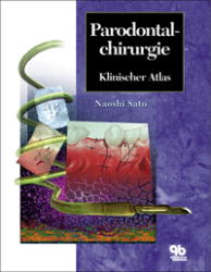 ISBN 9783876526935: Parodontalchirurgie - Klinischer Atlas