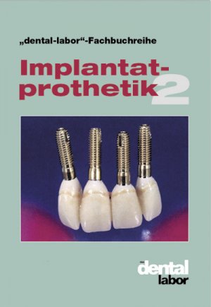 ISBN 9783929360974: Implantatprothetik 2