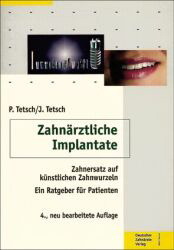 ISBN 9783934280229: Zahnärztliche Implantate : Zahnersatz auf künstlichen Zahnwurzeln : Ein Ratgeber für Patienten