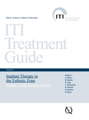 ISBN 9783938947104: ITI treatment guide vol. 1. Implant therapy in the esthetic zone : single-tooth replacements.