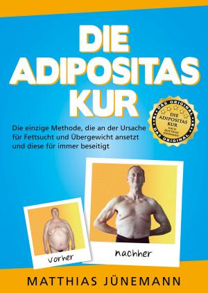 ISBN 9783957600004: Die Adipositas-Kur - Mit hCG an der Ursache für Fettsucht und Übergewicht ansetzen und diese für immer beseitigen