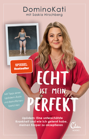 ISBN 9783959103664: Echt ist mein Perfekt - Lipödem: Eine unterschätzte Krankheit und wie ich gelernt habe, meinen Körper zu akzeptieren