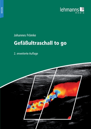 ISBN 9783965433168: Gefäßultraschall to go