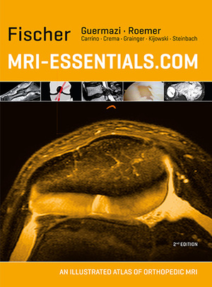 Wolfgang Fischer - MRI-Essentials.com An Illustrated Atlas of Orthopedic MRI musculoskeletal MRI orthopedics sports medicine Medizinische Fachgebiete Radiologie Bildgebende Verfahren Kernspintomographie MRT Imaging Magnetic Resonance Imaging MRI Radiology Wolfgang Fischer