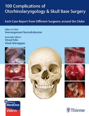 ISBN 9789395390576: 100 Complications of Otorhinolaryngology & Skull Base Surgery