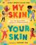 Henry-Allain, Laura, MBE: My Skin, Your 