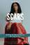 Makita Morton: Scars: Healing by sharing