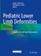 Pediatric Lower Limb Deformities