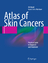 Atlas of Skin Cancers - Practical Guide to Diagnosis and Treatment