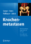 Knochenmetastasen - Pathophysiologie, Diagnostik und Therapie