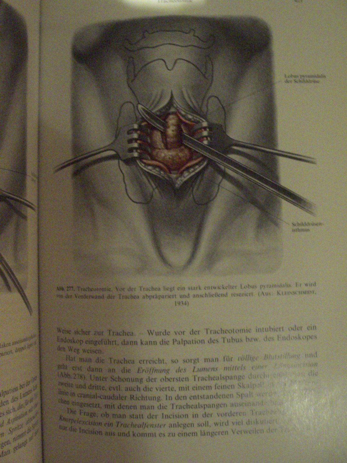 Die Oto Rhino Laryngologischen Operationen Im Mund Und Denecke H J Buch Gebraucht Kaufen A02bh4hs01zzu