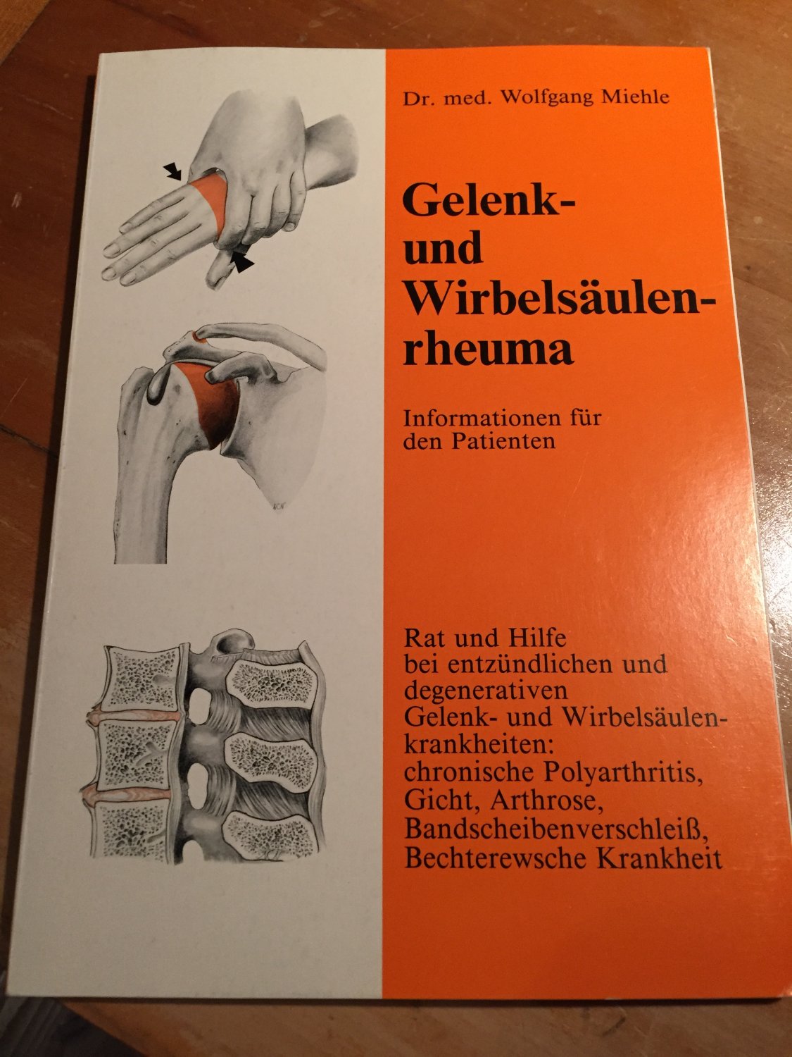 Gelenk- und Wirbelsäulenrheuma“ (Wolfgang Miehle) – Buch gebraucht kaufen –  A02us25501ZZV