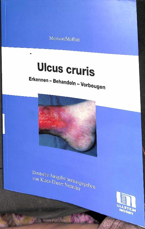 „Ulcus Cruris : Erkennen - Behandeln - Vorbeugen Von Moya Morison ...