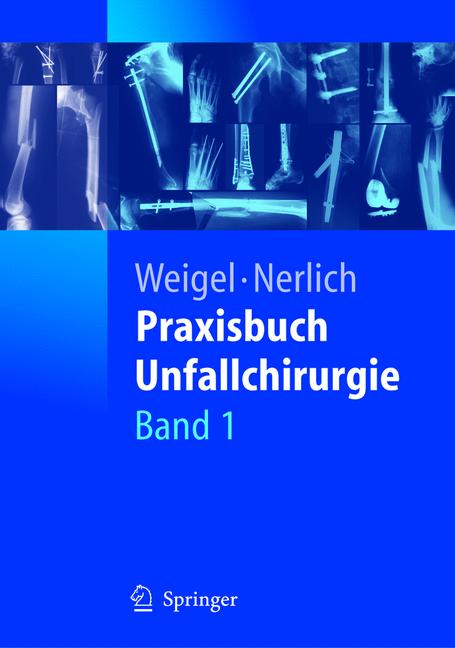 ISBN 3540411151 "Praxisbuch Unfallchirurgie" – Gebraucht, Antiquarisch ...